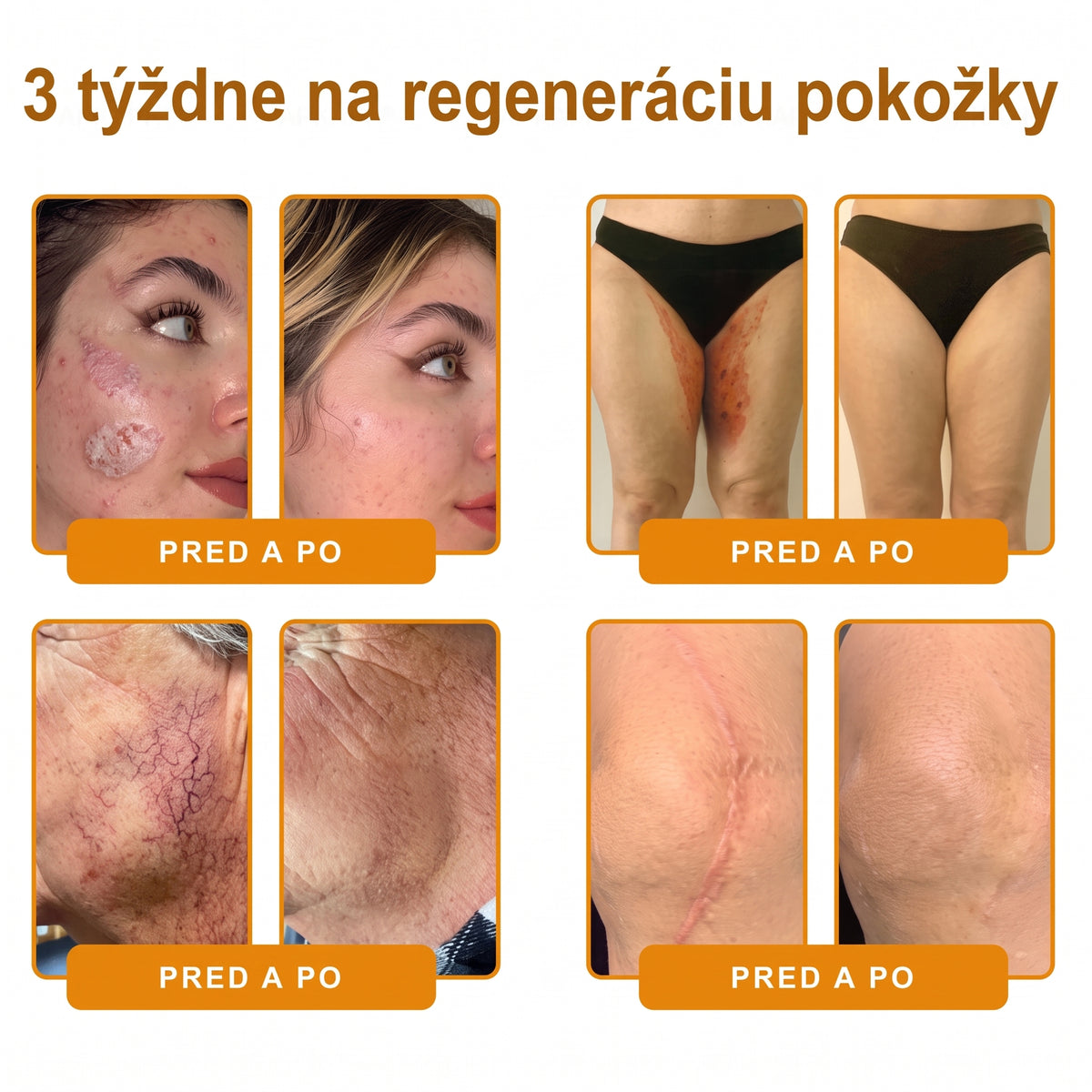 📢 🔥 VLSVLS® Včelí jed regeneračný krém na pokožku 🔥 Vyvinuté na Slovensku, vyrobené a dodávané zo Slovenska