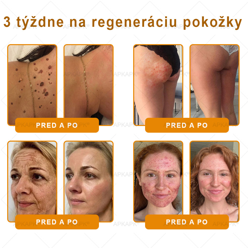 ✨ 🔥 VLSVLS® Včelí jed regeneračný krém na pokožku 🔥 Vyvinuté na Slovensku, vyrobené a dodávané zo Slovenska
