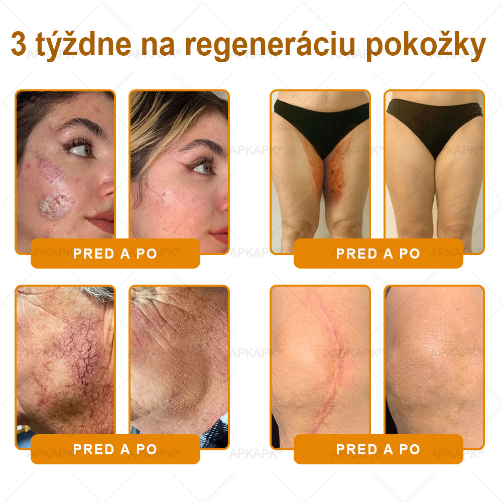✨ 🔥 VLSVLS® Včelí jed regeneračný krém na pokožku 🔥 Vyvinuté na Slovensku, vyrobené a dodávané zo Slovenska