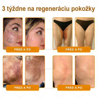 ✨ 🔥 VLSVLS® Včelí jed regeneračný krém na pokožku 🔥 Vyvinuté na Slovensku, vyrobené a dodávané zo Slovenska