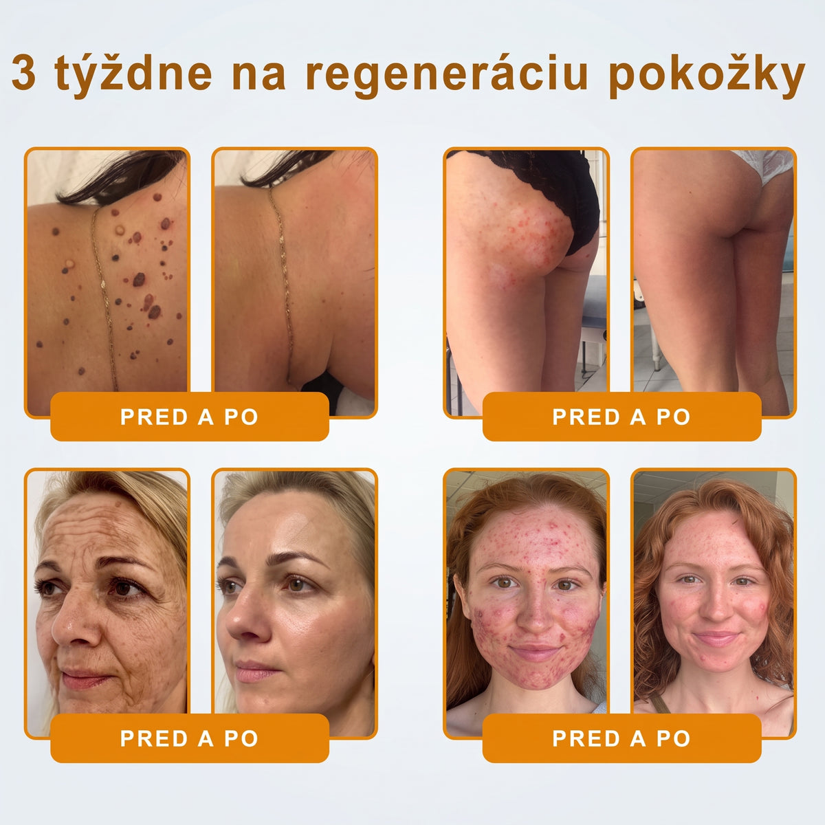 📢 🔥 VLSVLS® Včelí jed regeneračný krém na pokožku 🔥 Vyvinuté na Slovensku, vyrobené a dodávané zo Slovenska
