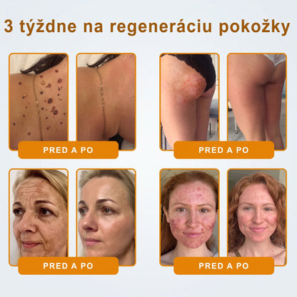 📢 🔥 VLSVLS® Včelí jed regeneračný krém na pokožku 🔥 Vyvinuté na Slovensku, vyrobené a dodávané zo Slovenska