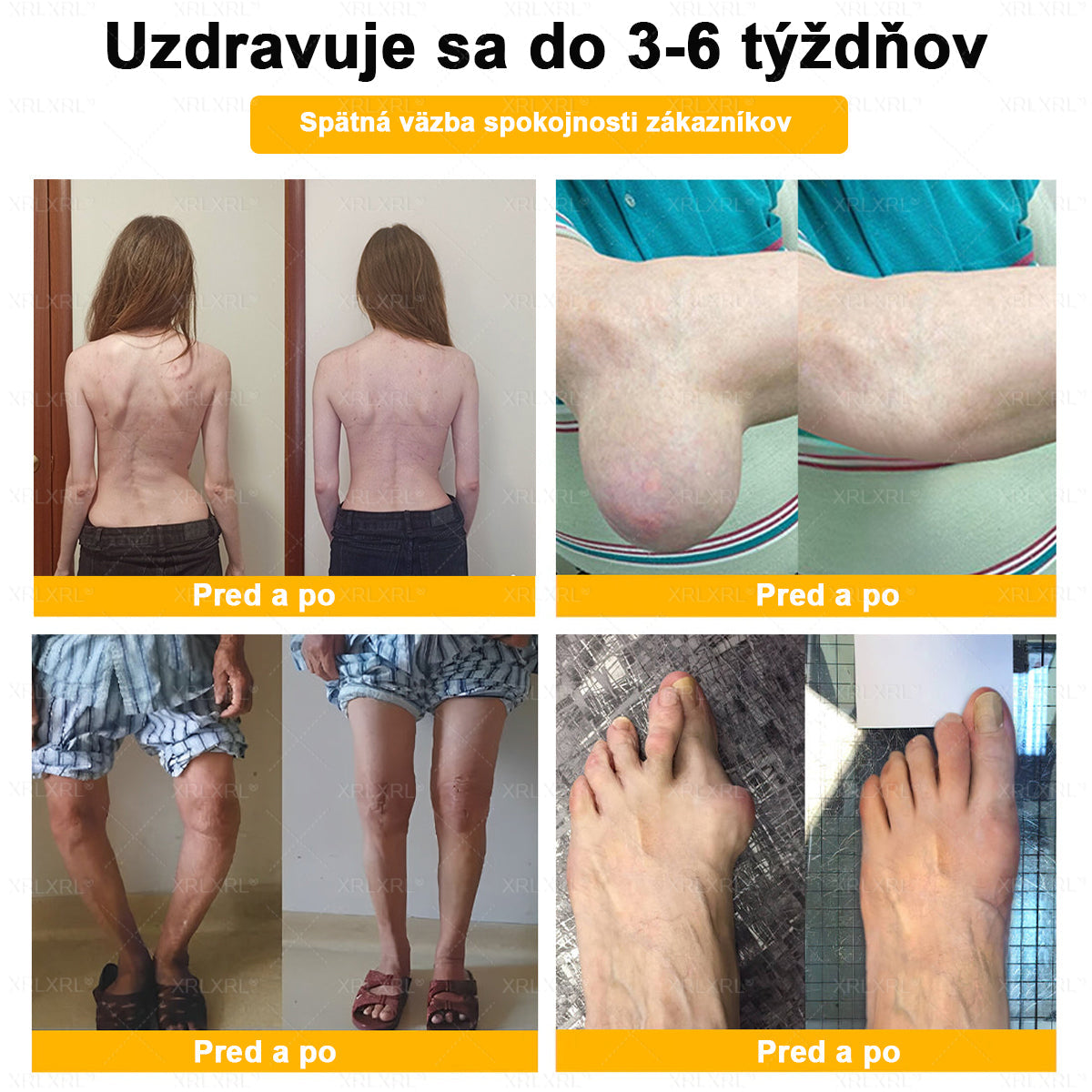 🎄𝙓𝙍𝙇𝙓𝙍𝙇® Krém proti bolesti a na hojenie kostí s včelím jedom (Špeciálne pre starších dospelých）