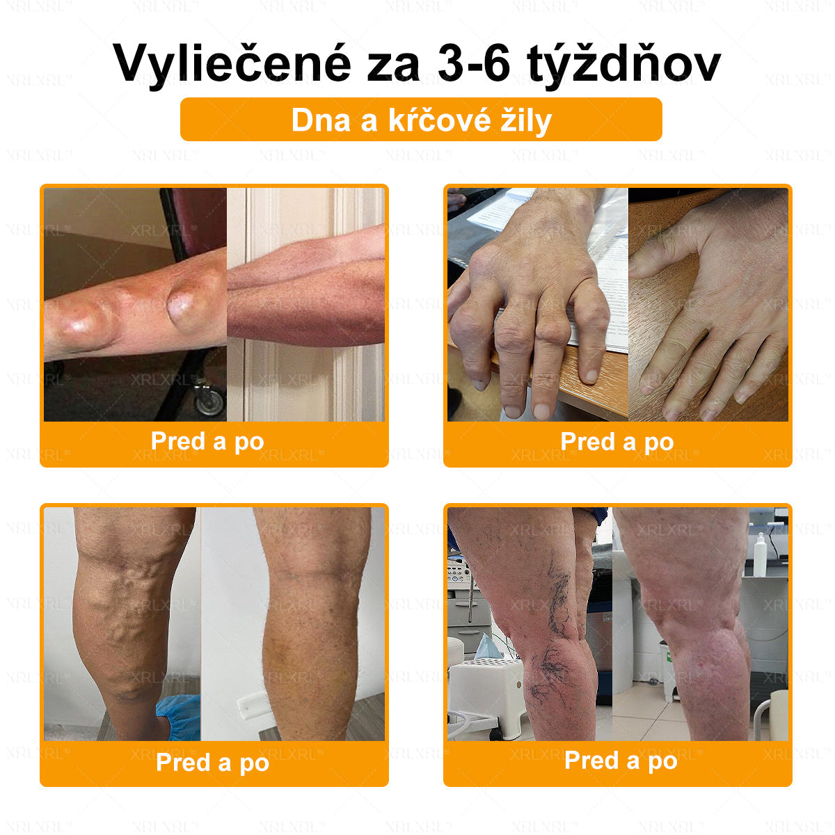 🎄𝙓𝙍𝙇𝙓𝙍𝙇® Krém proti bolesti a na hojenie kostí s včelím jedom (Špeciálne pre starších dospelých）