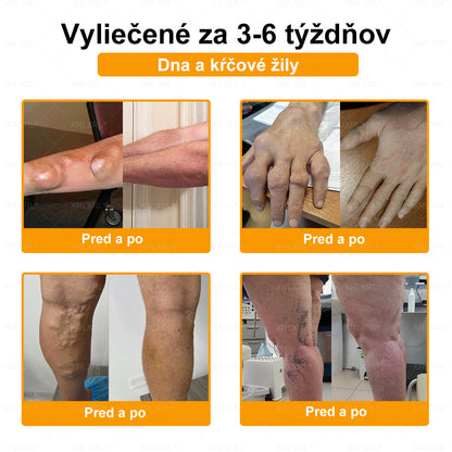 🎄𝙓𝙍𝙇𝙓𝙍𝙇® Krém proti bolesti a na hojenie kostí s včelím jedom (Špeciálne pre starších dospelých）