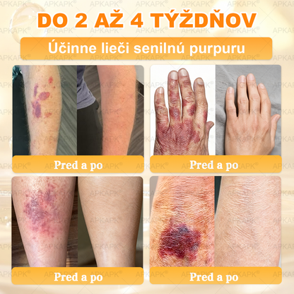 ✨ 🔥 VLSVLS® Včelí jed regeneračný krém na pokožku 🔥 Vyvinuté na Slovensku, vyrobené a dodávané zo Slovenska