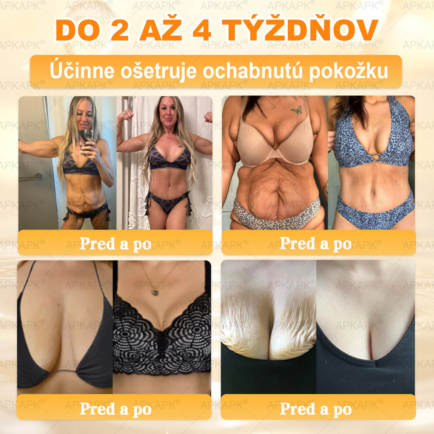 ✨ 🔥 VLSVLS® Včelí jed regeneračný krém na pokožku 🔥 Vyvinuté na Slovensku, vyrobené a dodávané zo Slovenska