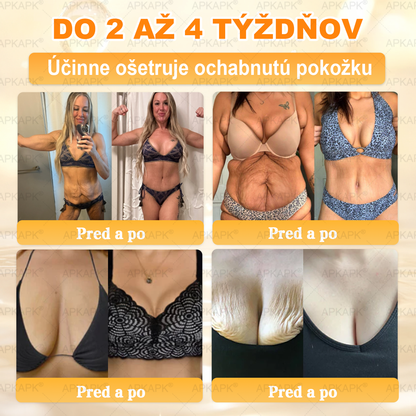 ✨ 🔥 VLSVLS® Včelí jed regeneračný krém na pokožku 🔥 Vyvinuté na Slovensku, vyrobené a dodávané zo Slovenska