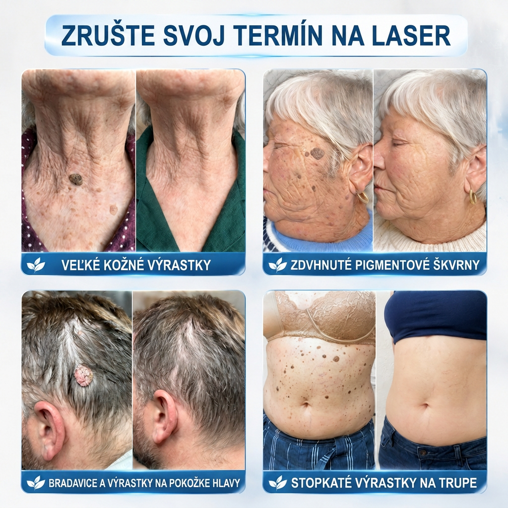 𝑶𝒇𝒊𝒄𝒊á𝒍𝒏𝒚 𝒐𝒃𝒄𝒉𝒐𝒅 👨‍⚕️🍀| 𝐇𝐈𝐒𝐊𝐈𝐍® 7-𝒅ň𝒐𝒗ý 𝒑𝒓í𝒑𝒓𝒂𝒗𝒐𝒌 𝒏𝒂 𝒐𝒅𝒔𝒕𝒓á𝒏𝒆𝒏𝒊𝒆 𝒌𝒐ž𝒏ý𝒄𝒉 𝒗ý𝒓𝒂𝒔𝒕𝒌𝒐𝒗 𝒂 𝒑𝒊𝒈𝒎𝒆𝒏𝒕𝒐𝒗ý𝒄𝒉 š𝒌𝒗ŕ𝒏👩‍⚕️ (𝒃𝒆𝒛 𝒃𝒐𝒍𝒆𝒔𝒕𝒊, 𝒃𝒆𝒛 𝒋𝒂𝒛𝒊𝒆𝒗, 𝒑𝒓𝒆𝒔𝒏ý 𝒓𝒐𝒍𝒍-𝒐𝒏 𝒂𝒑𝒍𝒊𝒌á𝒕𝒐𝒓) 🔥