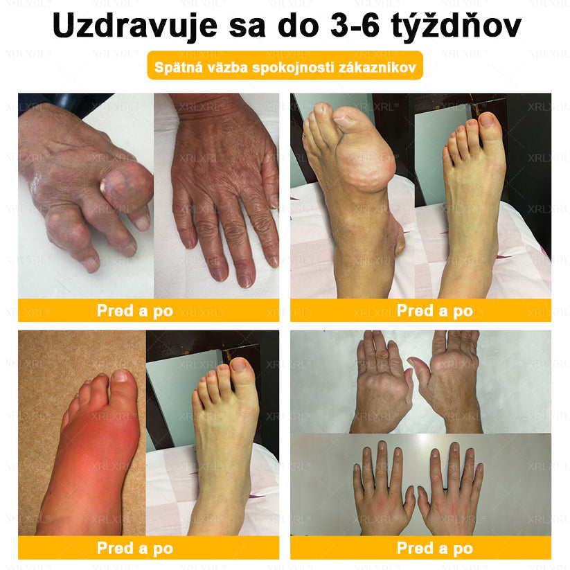 🎄𝙓𝙍𝙇𝙓𝙍𝙇® Krém proti bolesti a na hojenie kostí s včelím jedom (Špeciálne pre starších dospelých）