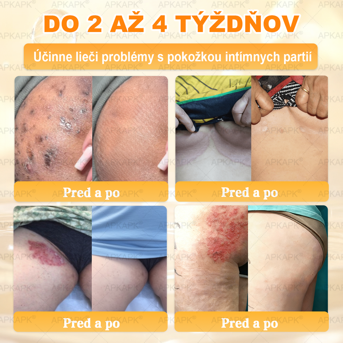 ✨ 🔥 VLSVLS® Včelí jed regeneračný krém na pokožku 🔥 Vyvinuté na Slovensku, vyrobené a dodávané zo Slovenska