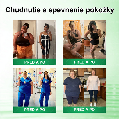 𝐴𝑁𝐺𝐸𝐿𝑇𝑅𝐴𝑃®📦 Moringa × Berberine × AMPK 10-in-1 Metabolic Support Nano Microneedle Patch 🇸🇰 (Na použitie iba raz denne, viditeľné zmeny už po 7 dňoch) ✅ Podporuje chudnutie, metabolické zdravie, spánkovú apnoe, problémy s kĺbmi a mnoho ďalších výhod