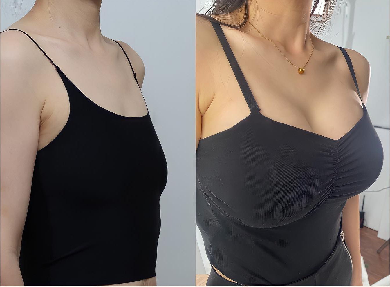 💦HISKIN® Náplasti s mikroihličkami na zväčšenie objemu, spevnenie a lifting poprsia