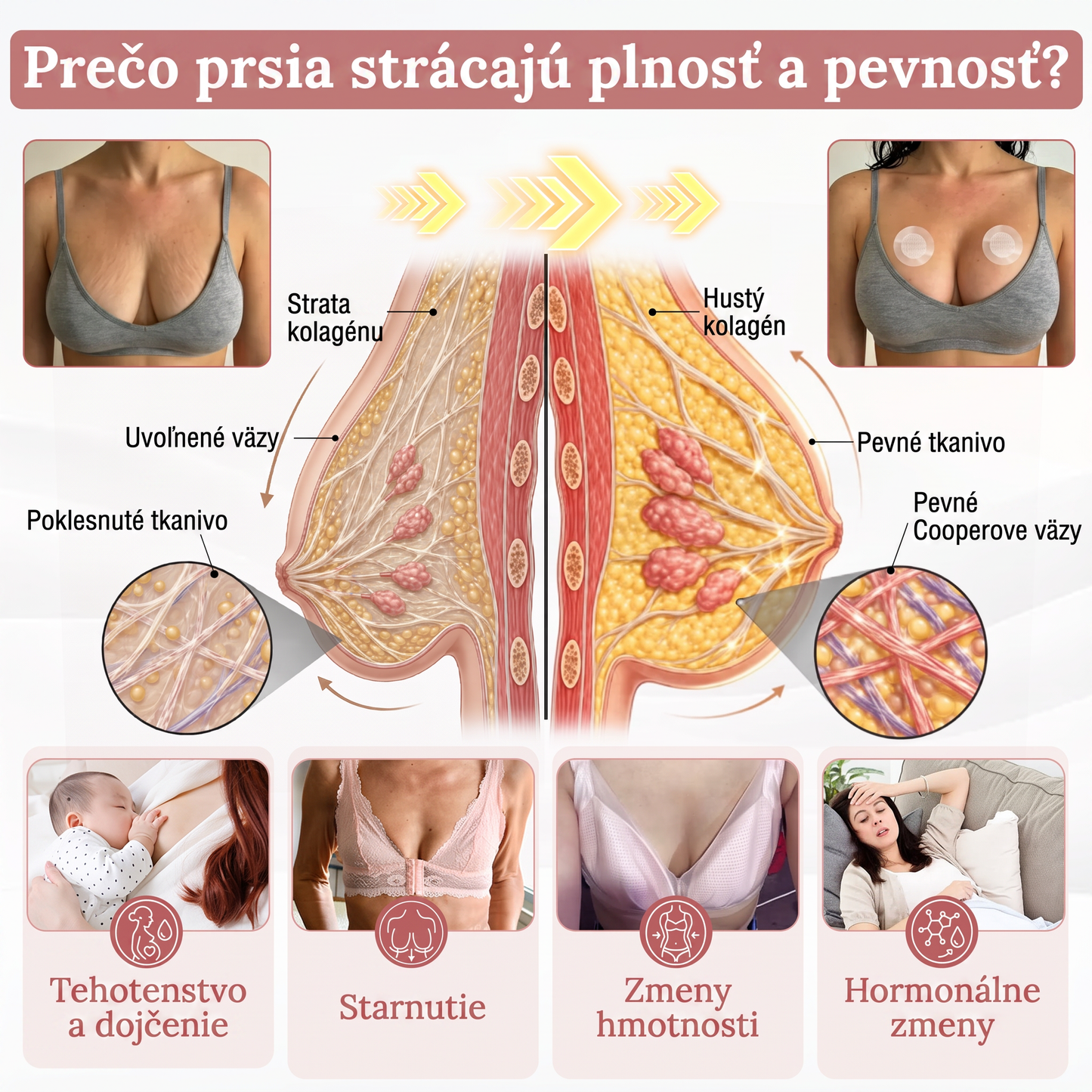 💦HISKIN® Náplasti s mikroihličkami na zväčšenie objemu, spevnenie a lifting poprsia