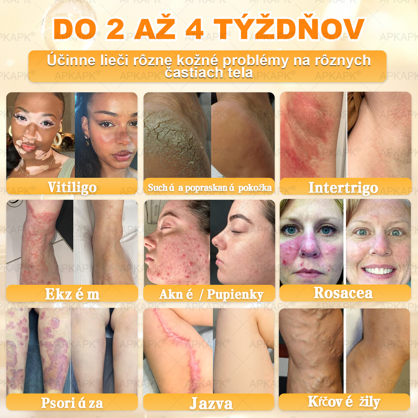 ✨ 🔥 VLSVLS® Včelí jed regeneračný krém na pokožku 🔥 Vyvinuté na Slovensku, vyrobené a dodávané zo Slovenska