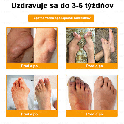 🎄𝙓𝙍𝙇𝙓𝙍𝙇® Krém proti bolesti a na hojenie kostí s včelím jedom (Špeciálne pre starších dospelých）