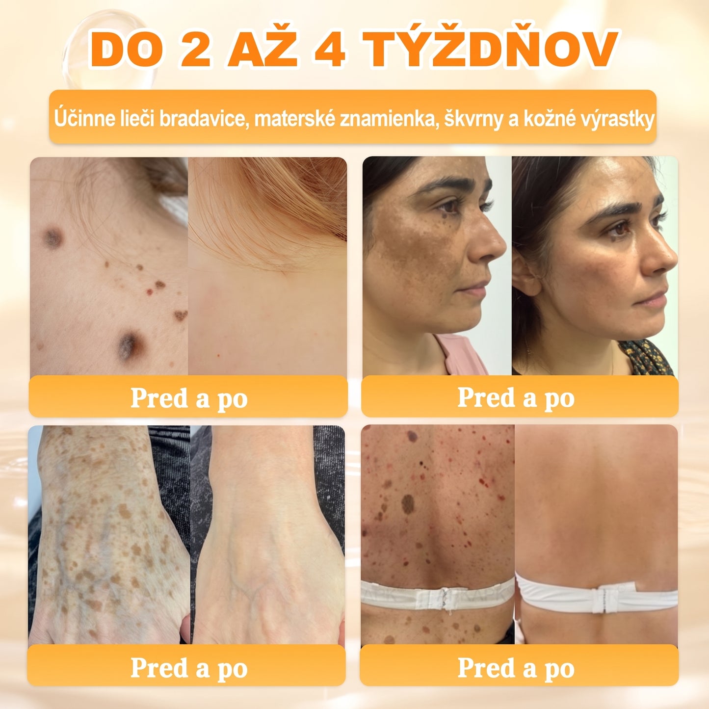 📢 🔥 VLSVLS® Včelí jed regeneračný krém na pokožku 🔥 Vyvinuté na Slovensku, vyrobené a dodávané zo Slovenska