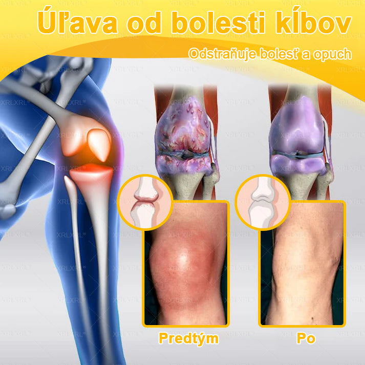 🎄𝙓𝙍𝙇𝙓𝙍𝙇® Krém proti bolesti a na hojenie kostí s včelím jedom (Špeciálne pre starších dospelých）