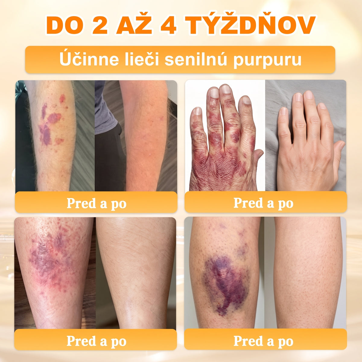 📢 🔥 VLSVLS® Včelí jed regeneračný krém na pokožku 🔥 Vyvinuté na Slovensku, vyrobené a dodávané zo Slovenska
