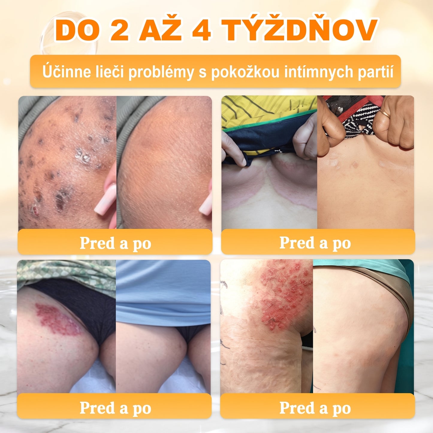 📢 🔥 VLSVLS® Včelí jed regeneračný krém na pokožku 🔥 Vyvinuté na Slovensku, vyrobené a dodávané zo Slovenska