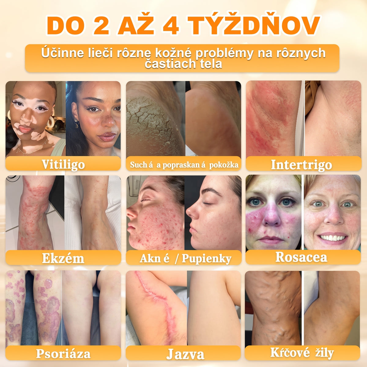 📢 🔥 VLSVLS® Včelí jed regeneračný krém na pokožku 🔥 Vyvinuté na Slovensku, vyrobené a dodávané zo Slovenska