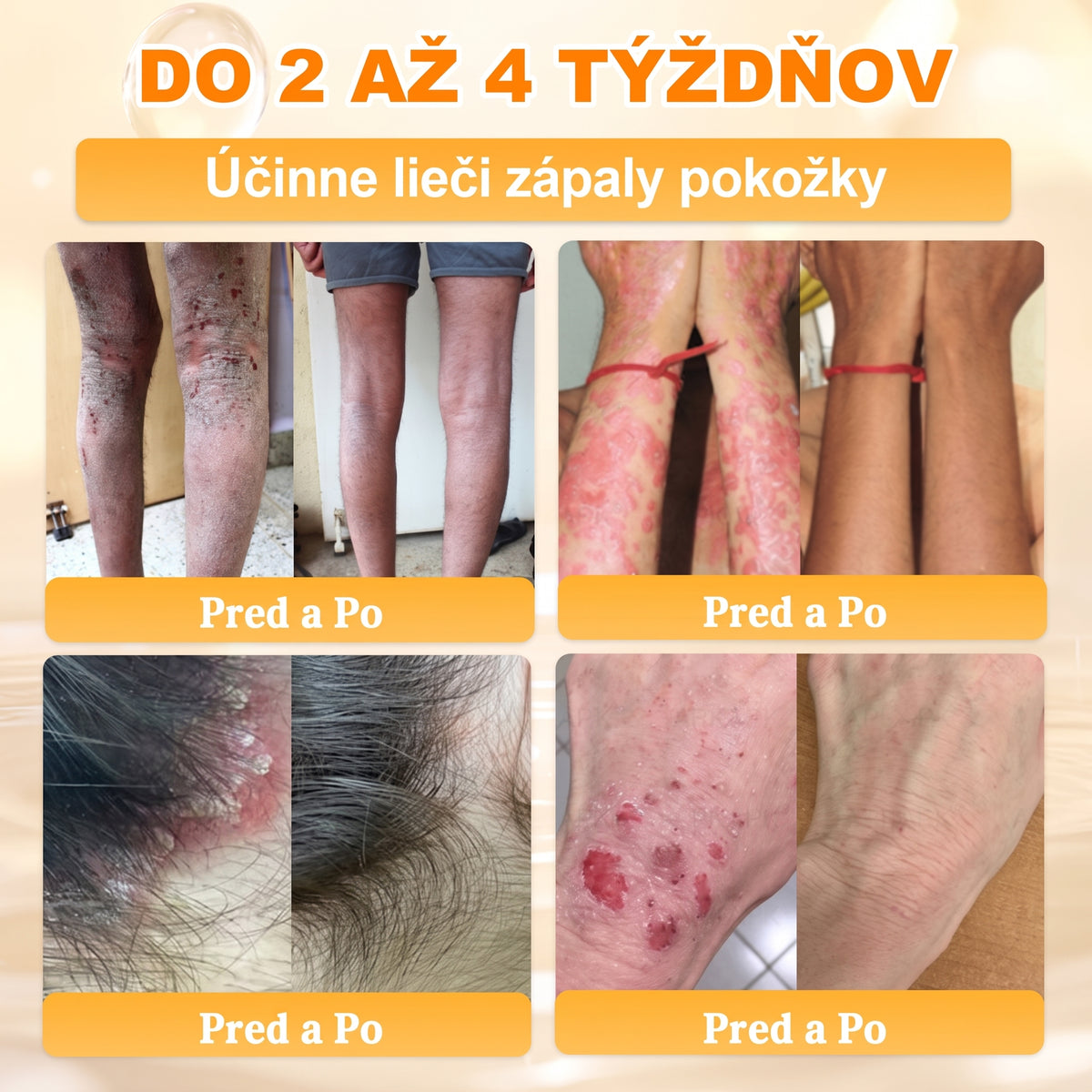 📢 🔥 VLSVLS® Včelí jed regeneračný krém na pokožku 🔥 Vyvinuté na Slovensku, vyrobené a dodávané zo Slovenska